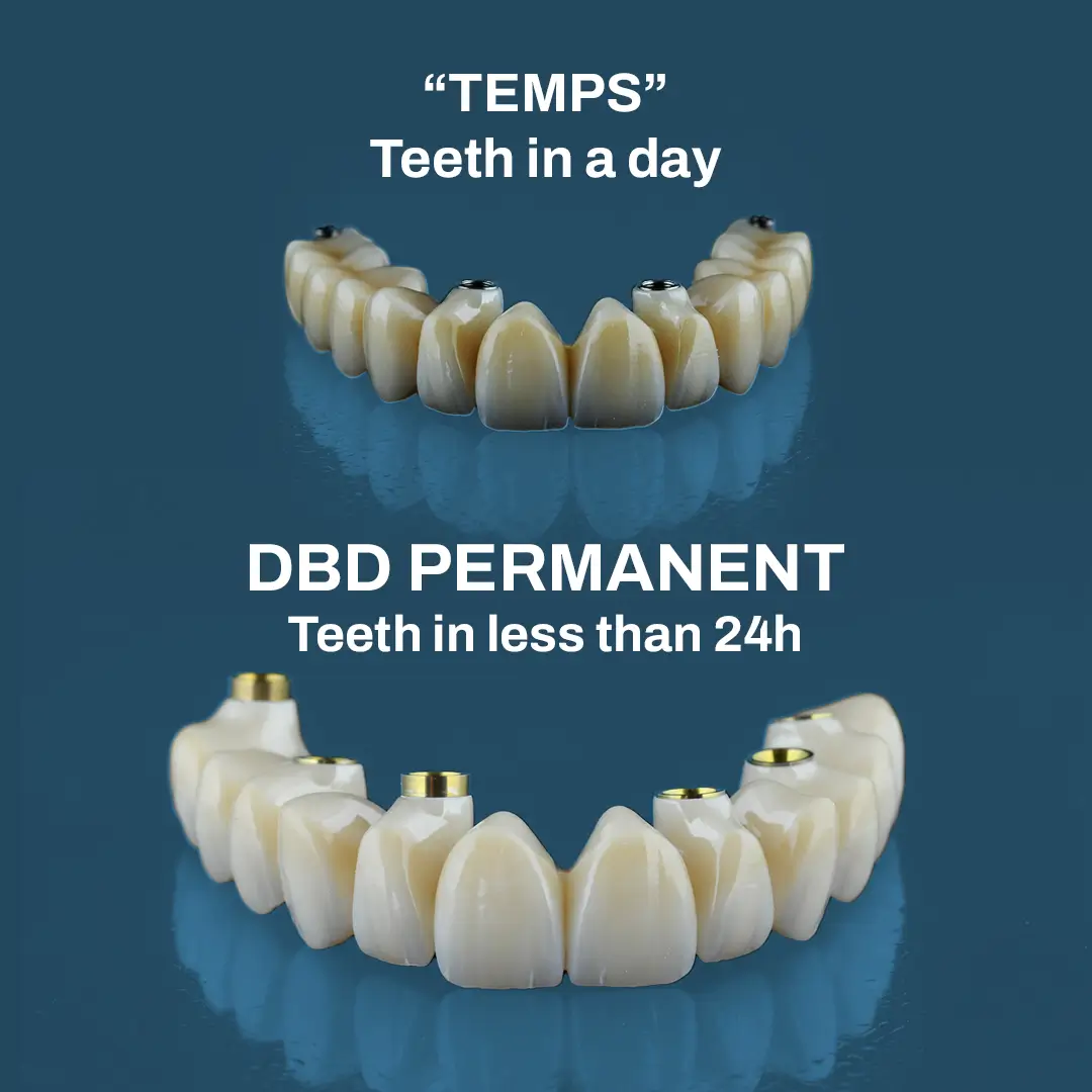 Teeth In A Day vs. 48-Hour Permanent Teeth