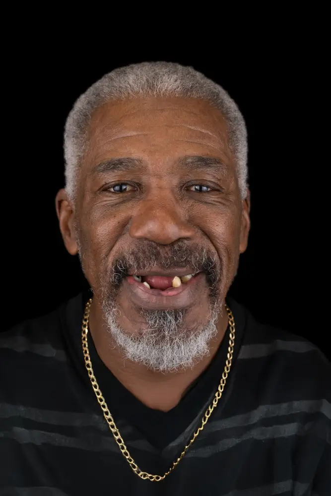 Curtis, 61 - Before