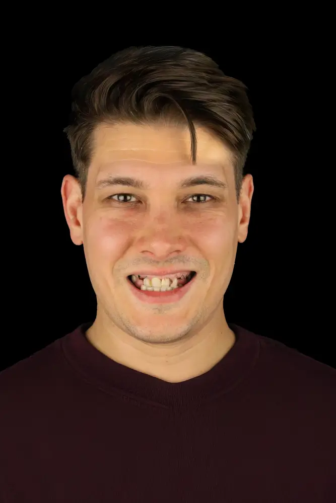 Evan, 36 - Before