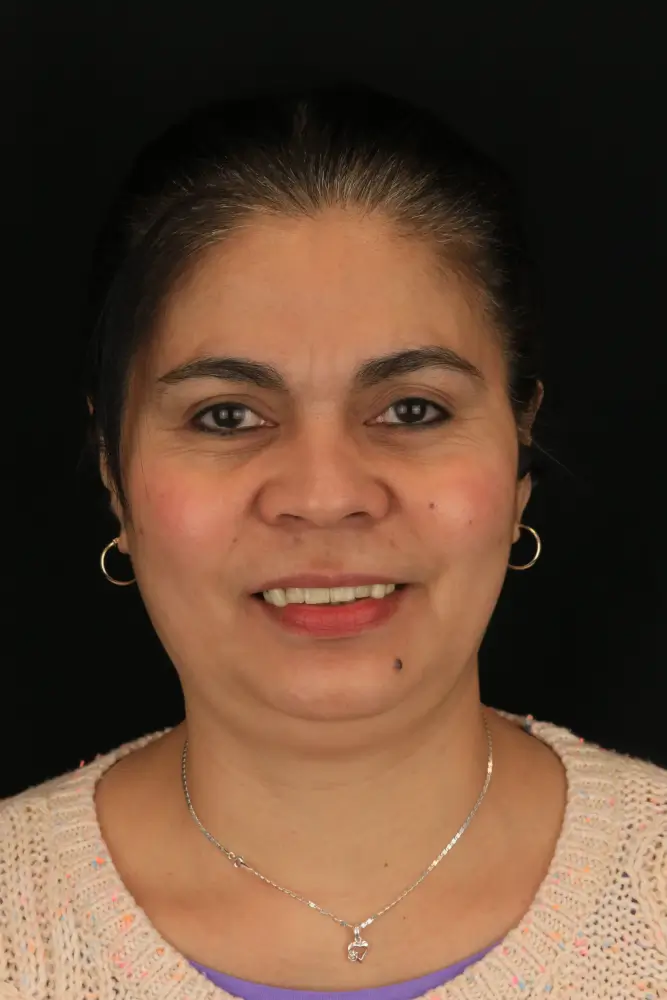 Maria, 56 - Before