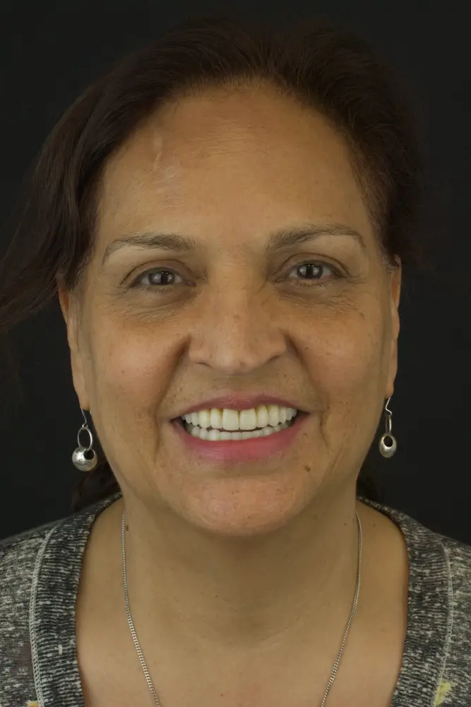 Melissa, 53 - After