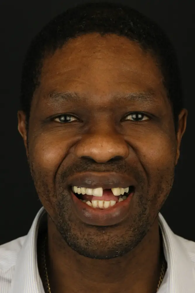 Simon, 56 - Before