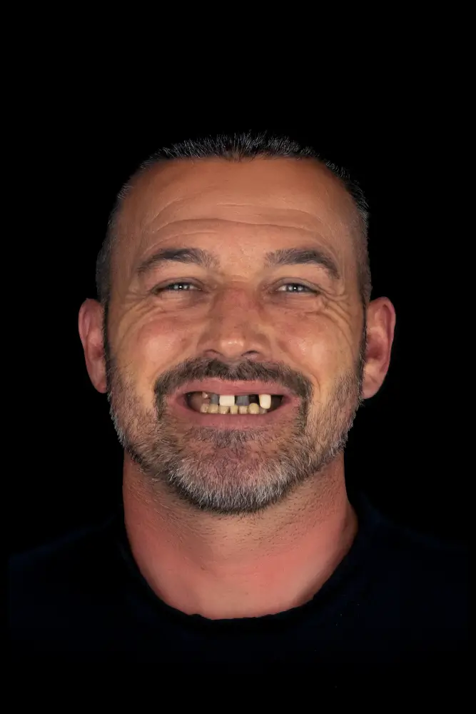 Stephen, 50 - Before