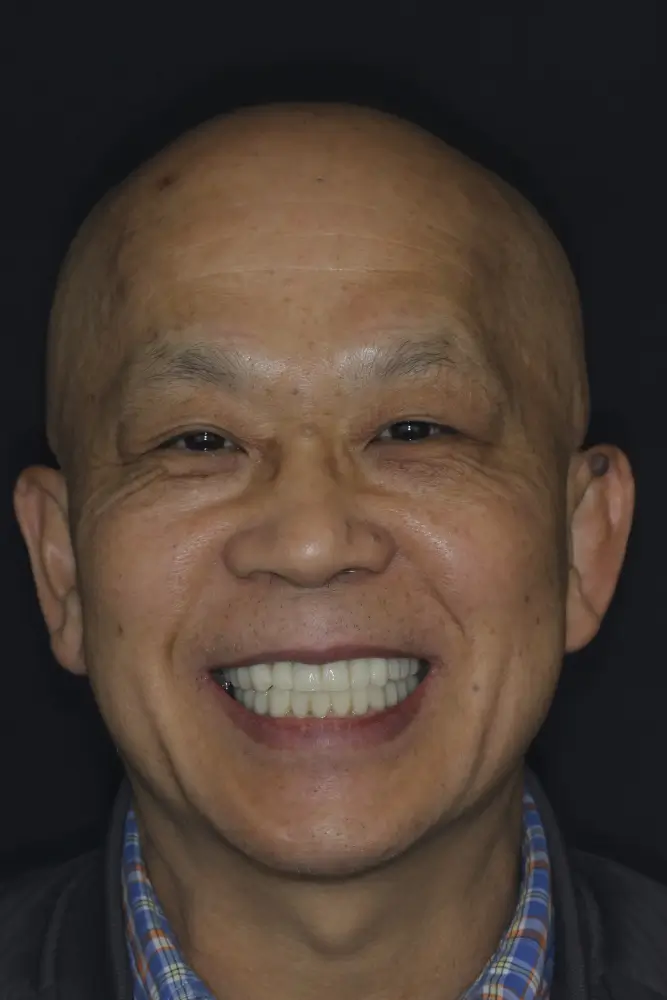 Wang, 70 - After