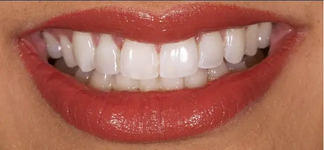 After treatment