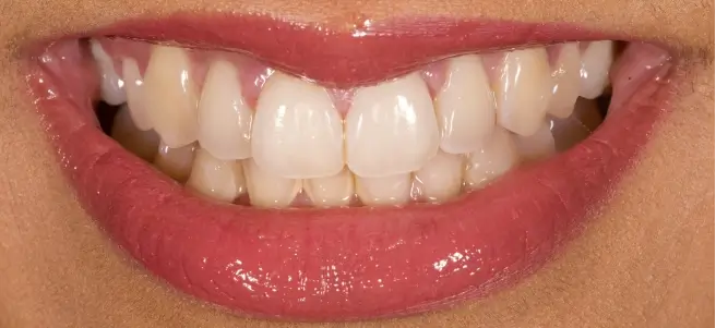 Before treatment