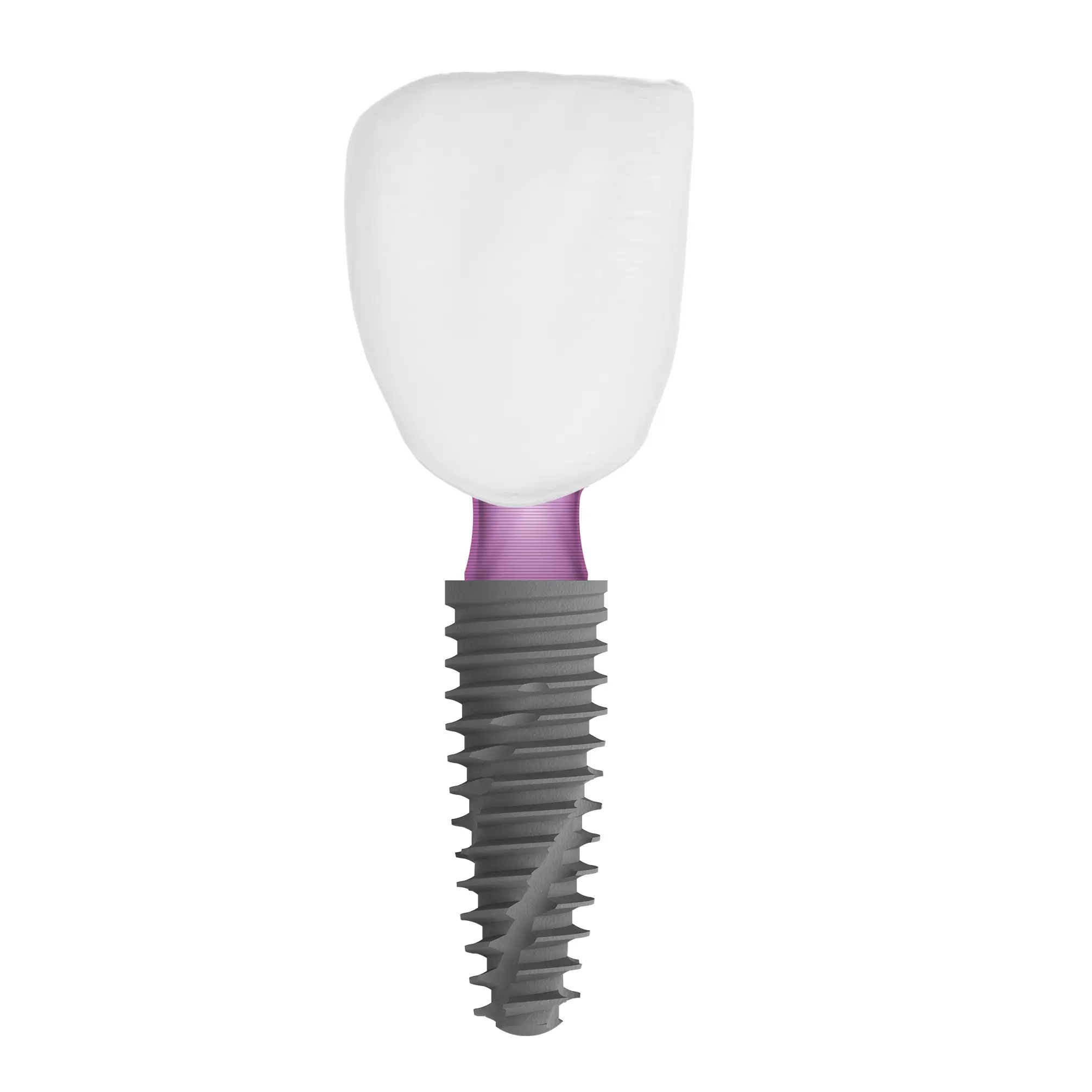 Single Implants